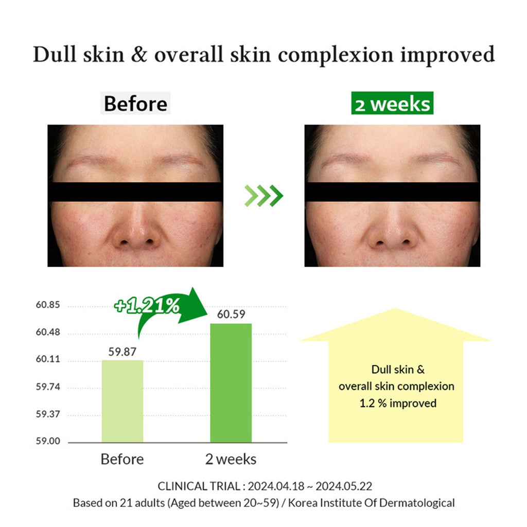 Dr.Althea Gentle Vitamin C Serum: Low-Irritation Brightening Serum for Sensitive Skin | Grocsy