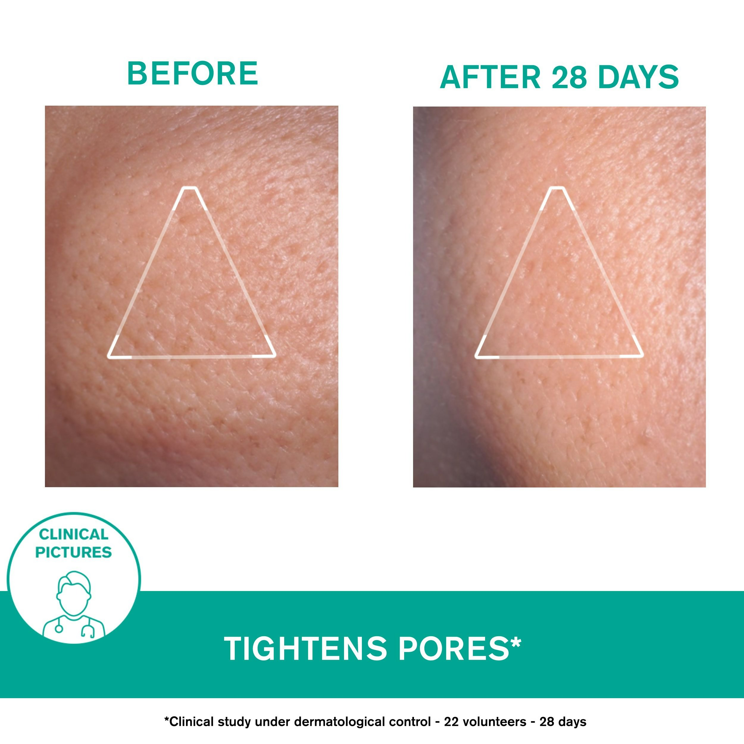 Uriage Hyseac Matifying Emulsion | Grocsy