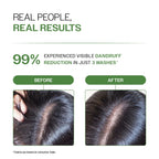 Bare Anatomy Expert Anti-Dandruff Shampoo with Salicylic Acid & Biotin | Grocsy