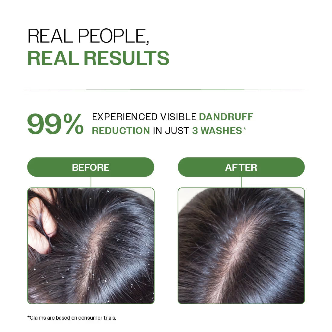 Bare Anatomy Expert Anti-Dandruff Shampoo with Salicylic Acid & Biotin | Grocsy