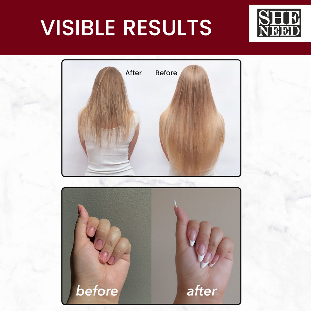 SheNeed Hair, Skin & Nails Vitamins Capsules | Grocsy