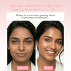 EOB Coenzyme Q10 Face Serum Day & Night Serum | Grocsy