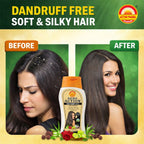 Action Pharma Shampoo Anti-Dandruff Enriched With Neem | Grocsy