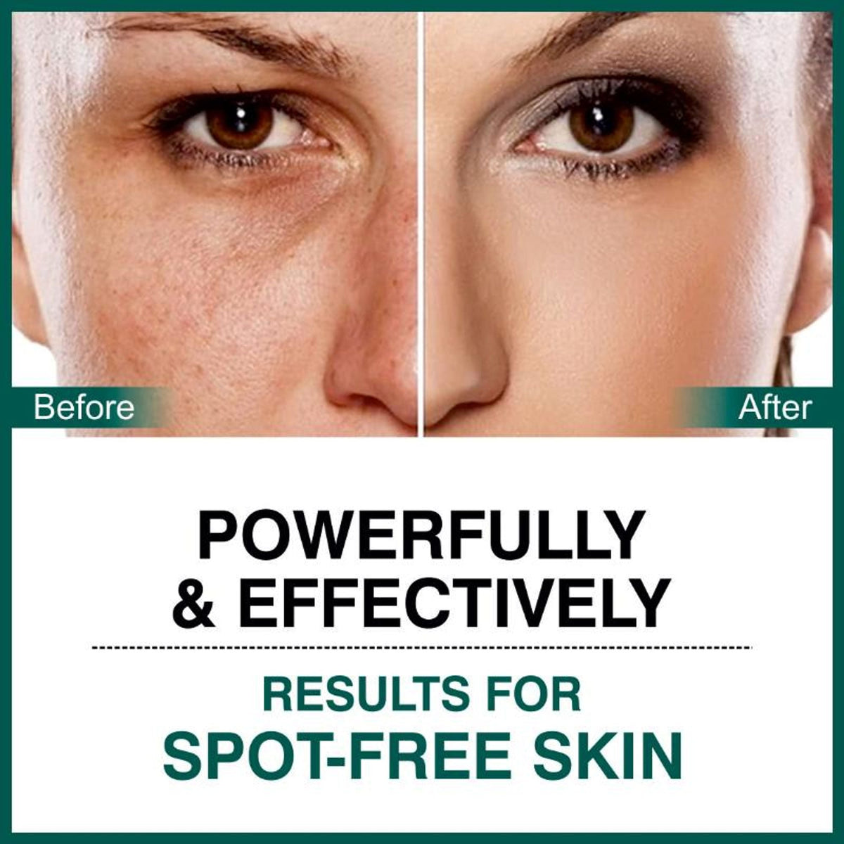 She Essentials Dark Spot Corrector Cream, Niacinamide & Vitamin E Oil | Grocsy