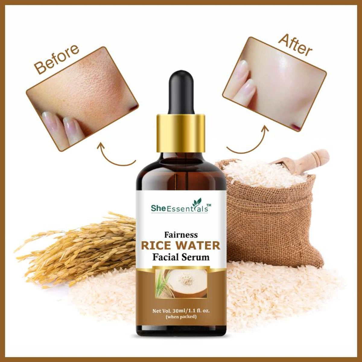 She Essentials Rice Water Fairness Face Serum For All Types Of Skin | Grocsy
