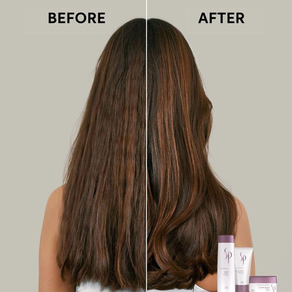 System Professional Clear Scalp Anti-dandruff Shampoo for Flake-Free & Itch-Free Scalp | Grocsy