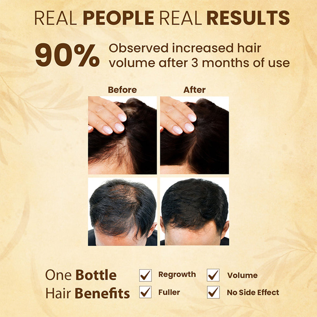 The Skin Story 100% Natural Ayurvedic Hair Oil For Hair Growth | Grocsy