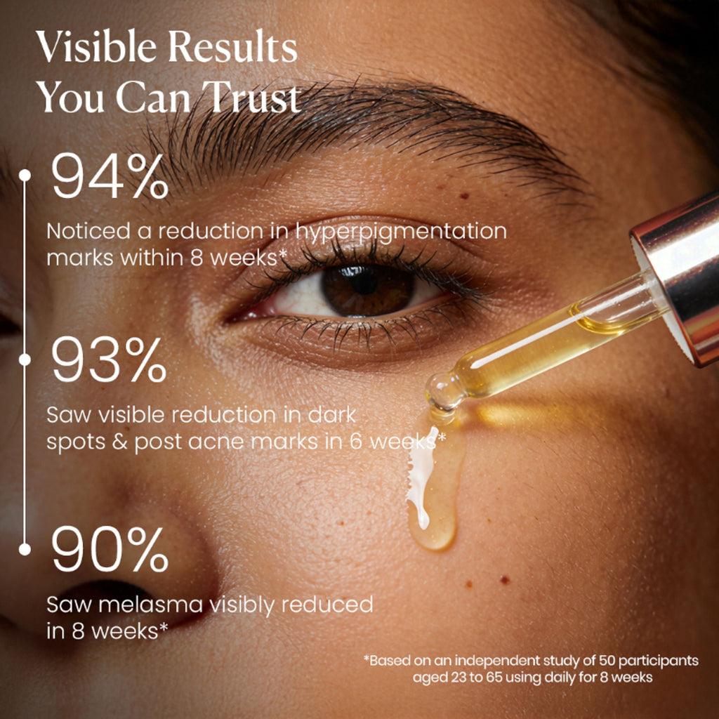 BiE - Beauty In Everything Zero Dark Spot Corrector & Anti-Pigmentation Serum | Grocsy
