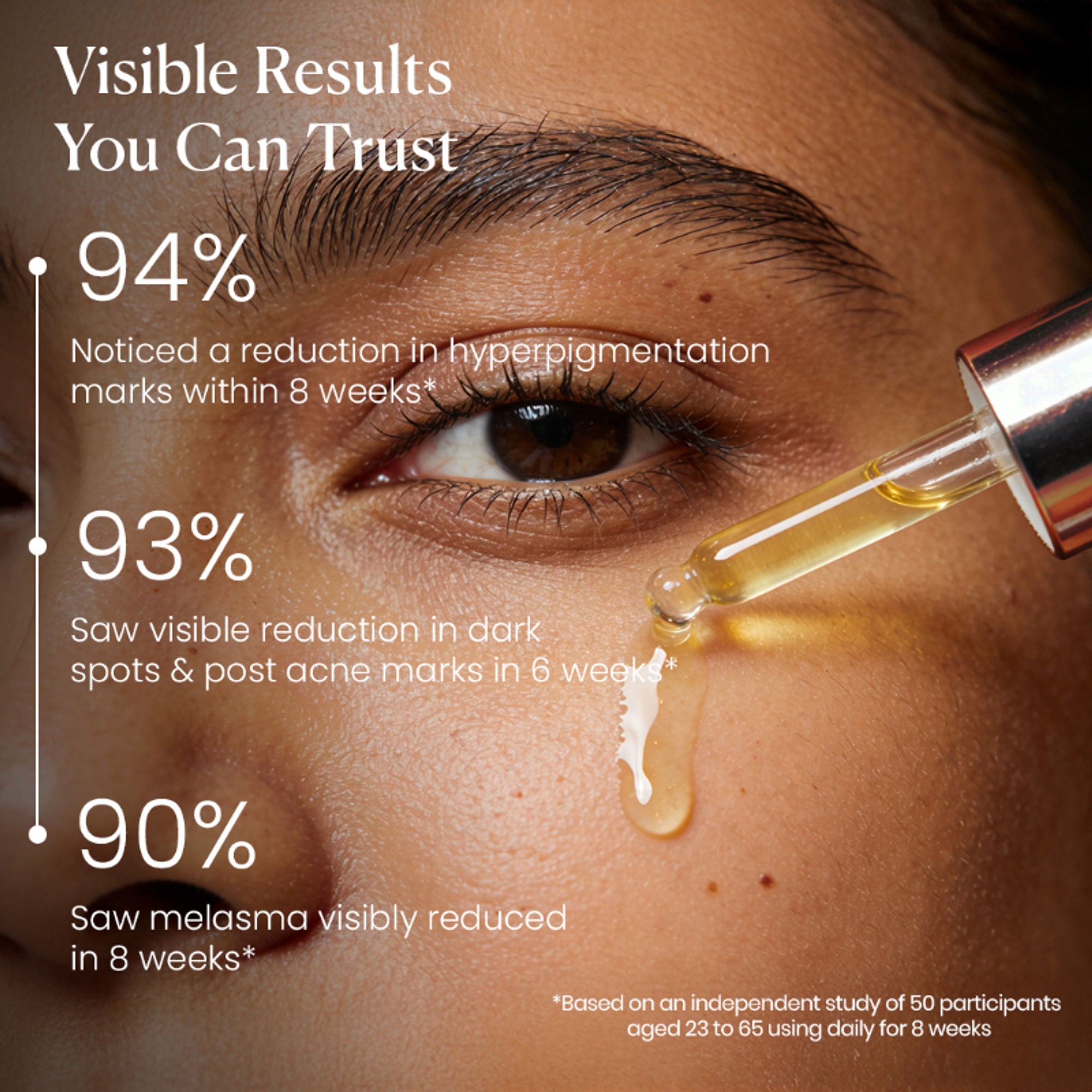 BiE - Beauty In Everything Zero Dark Spot Corrector & Anti-Pigmentation Serum | Grocsy
