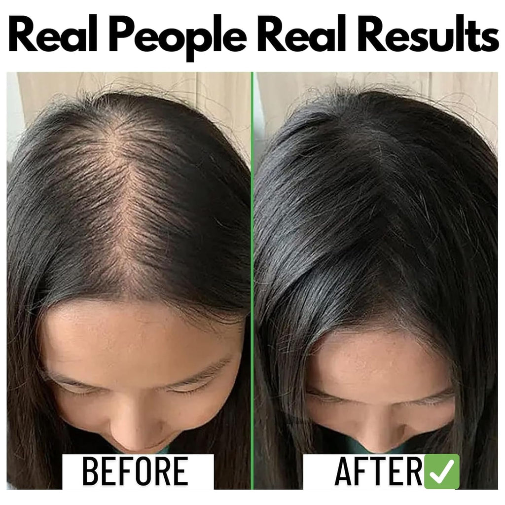 Samisha Rosemary Water Spray For Hair Growth & Thickness | Grocsy