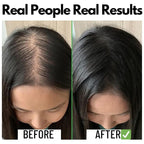 Samisha Rosemary Water Spray For Hair Growth & Thickness | Grocsy