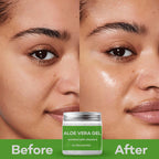 Samisha Multi Purpose Aloe Vera Gel | Grocsy