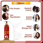 Newish Red Onion Shampoo For Hair Growth & Hair Fall Control | Grocsy