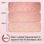 mCaffeine 11% AHA-BHA Skin Smoothening Strawberry Body Lotion | Grocsy