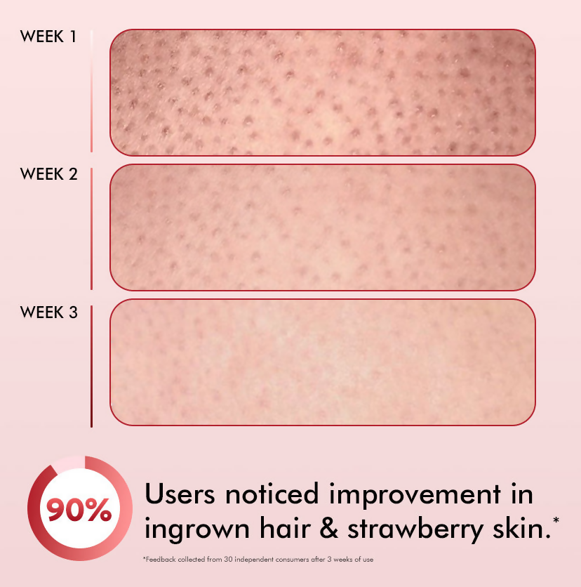 mCaffeine 11% AHA-BHA Skin Smoothening Strawberry Body Lotion | Grocsy
