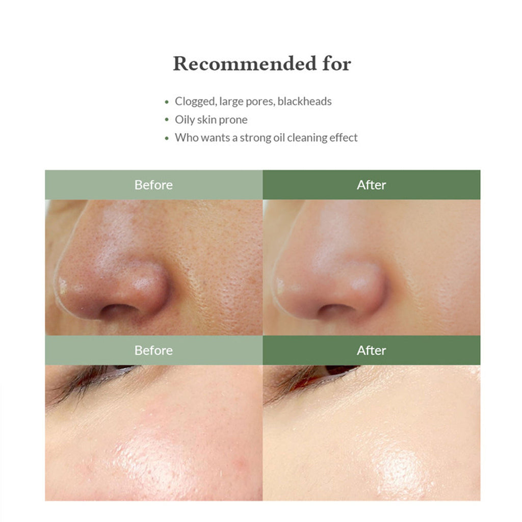 Dr.Althea Premium Sebum Control Cleanser: Deep Pore & Blackhead Cleansing Gel | Grocsy