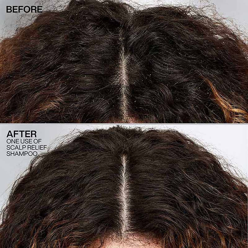 Redken Scalp Relief Anti Dandruff Shampoo For Men & Women | Grocsy