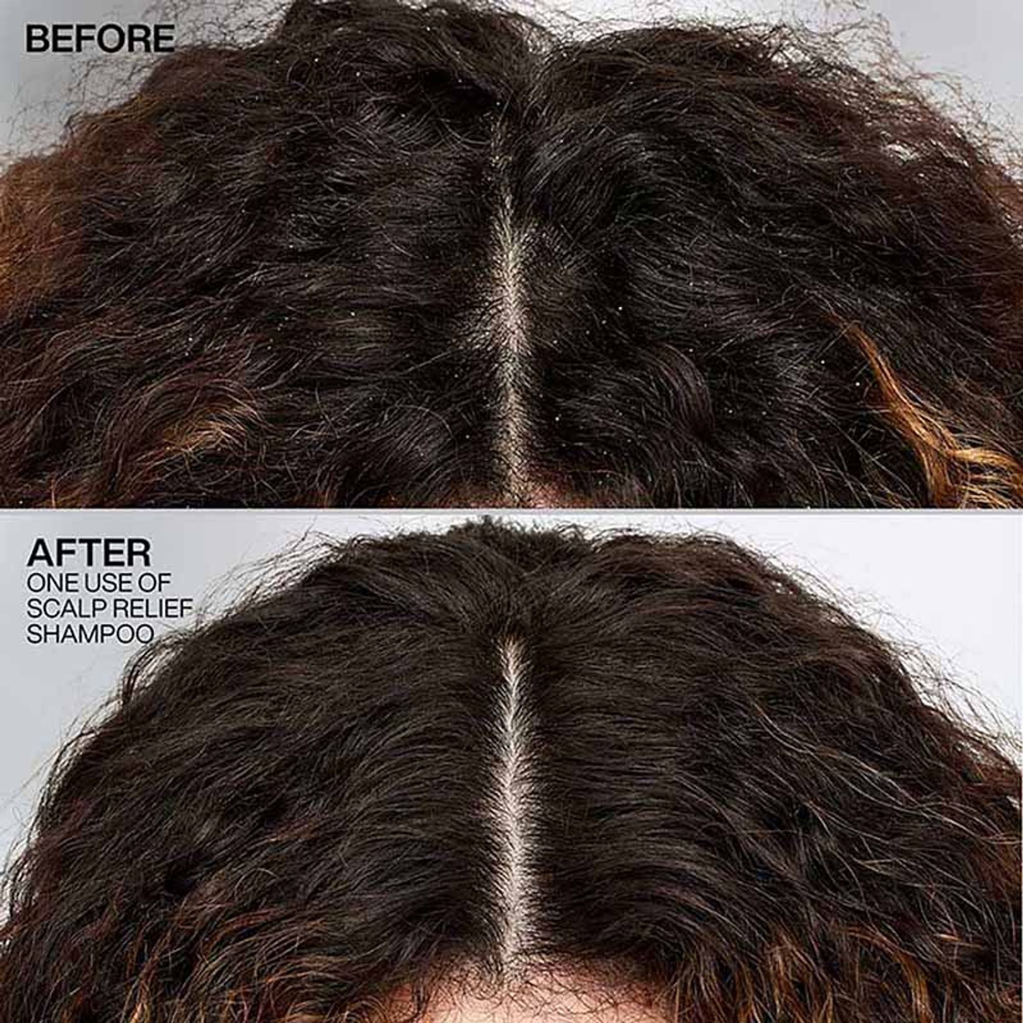 Redken Scalp Relief Anti Dandruff Shampoo For Men & Women | Grocsy