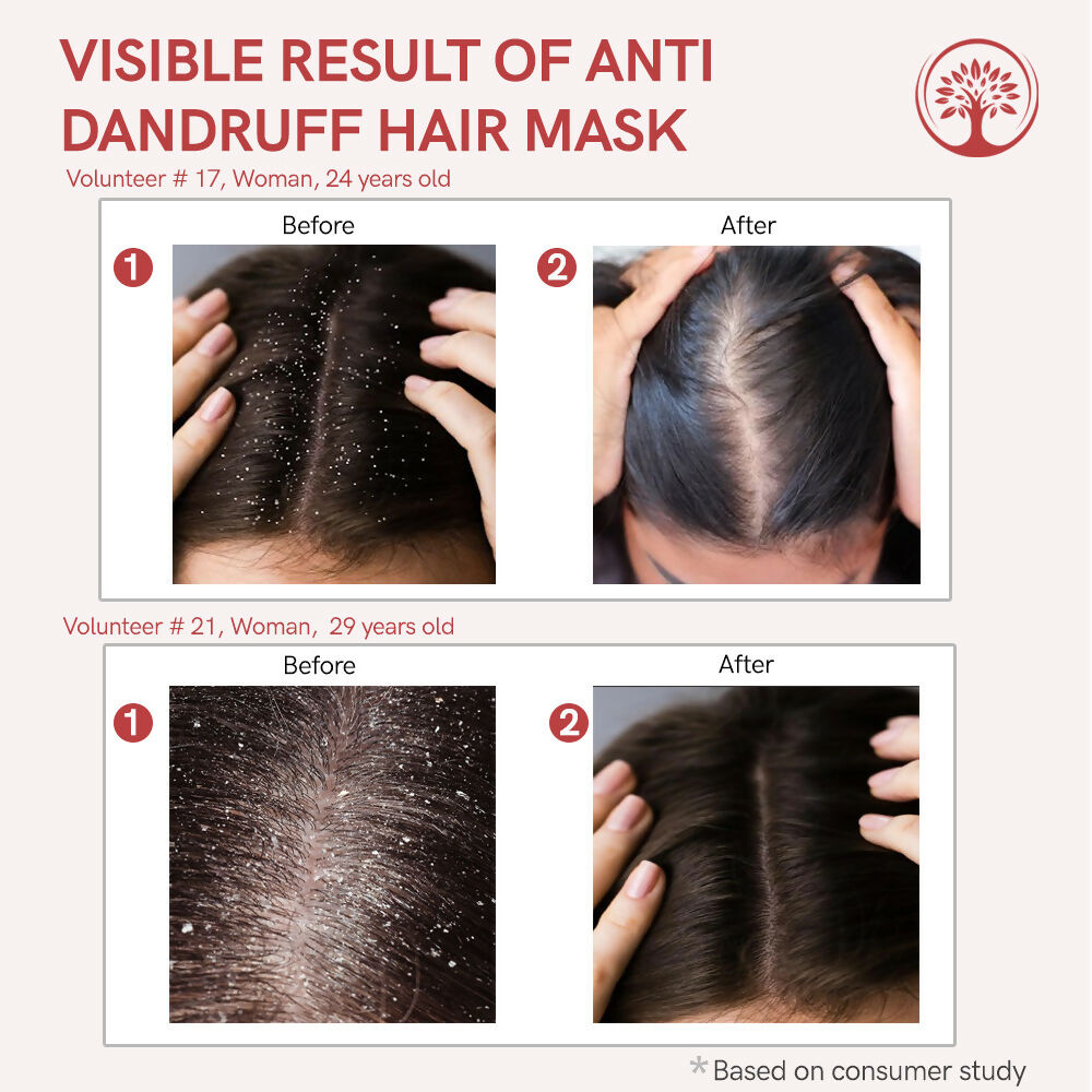 Ivory Natural Dandruff Hair Mask - Scalp Wellness, Assists With Dandruff For Both Men & Women | Grocsy