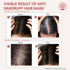 Ivory Natural Dandruff Hair Mask - Scalp Wellness, Assists With Dandruff For Both Men & Women | Grocsy