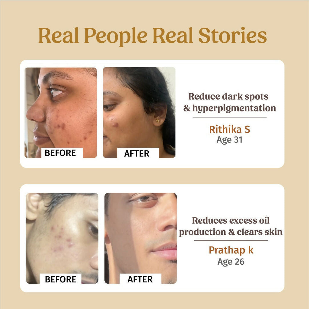 Vilvah Store Skin Hydration Kit | Grocsy