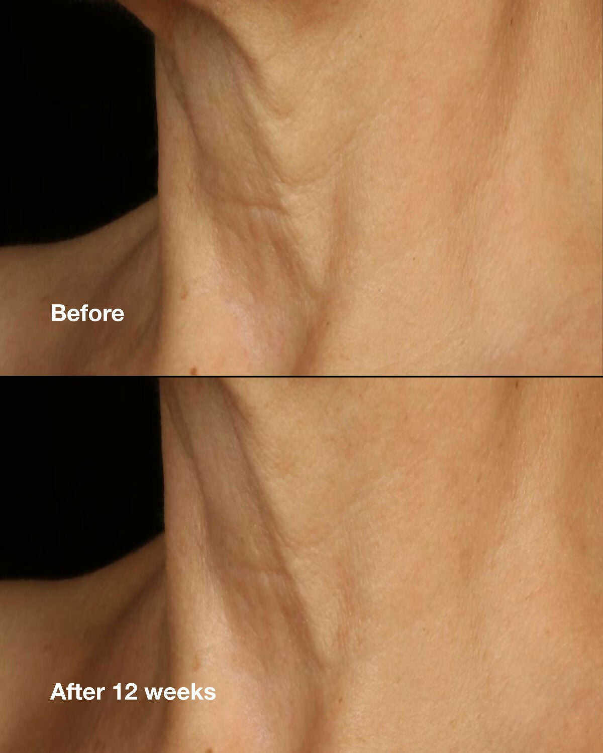 Clinique Smart Clinical Repair Lifting Face & Neck Cream | Grocsy