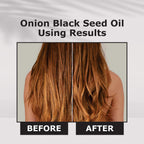 Nuerma Science Onion Black Seed Hair Oil | Grocsy