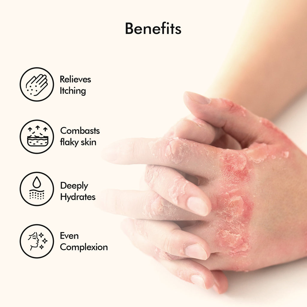 Vedicderm Psoriasis Cream with 2% Bakuchi Extract | Grocsy