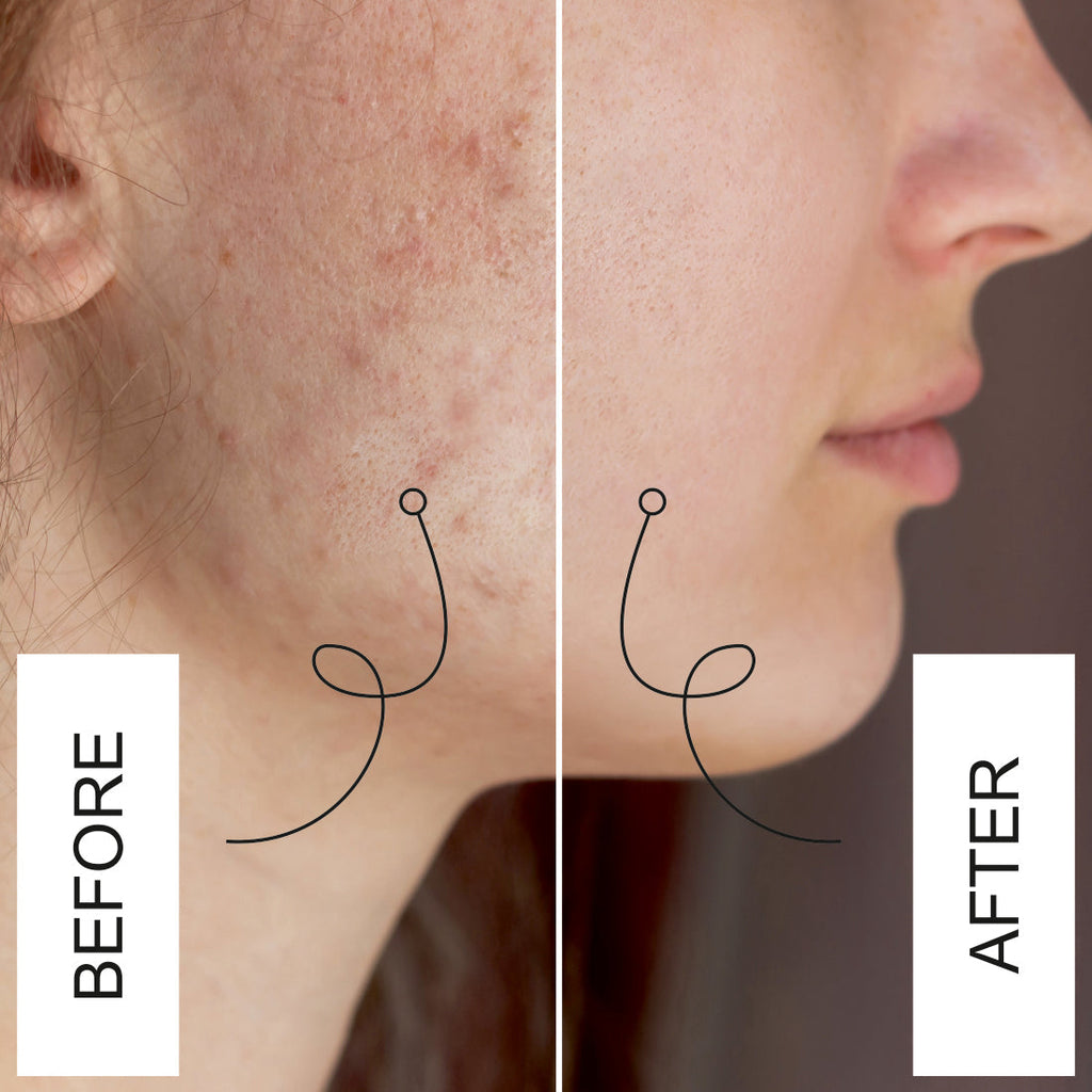 Nuerma Science Kumkumadi Face Oil For Glowing Face | Grocsy