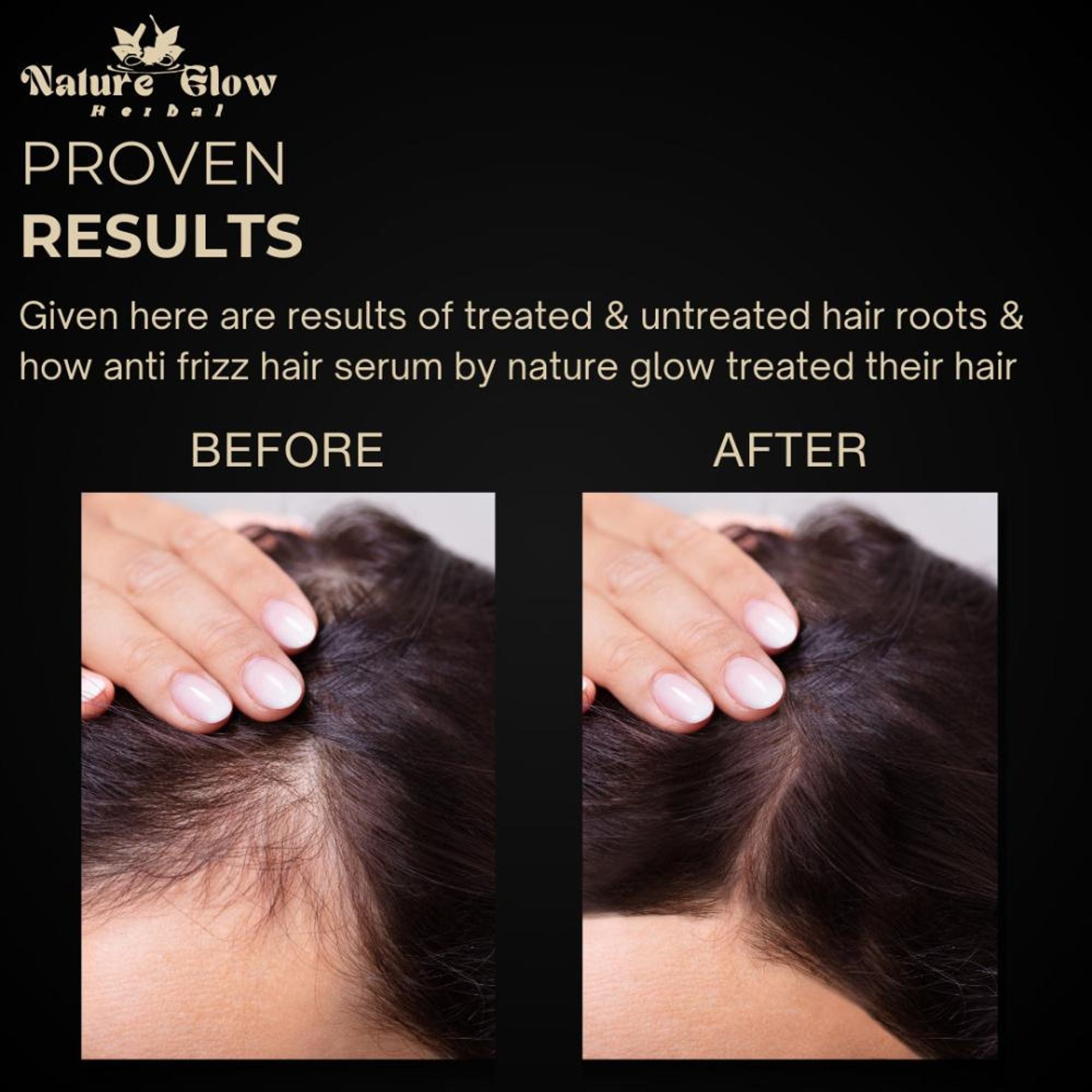 Nature Glow Herbal Anti Frizz Hair Serum | Grocsy