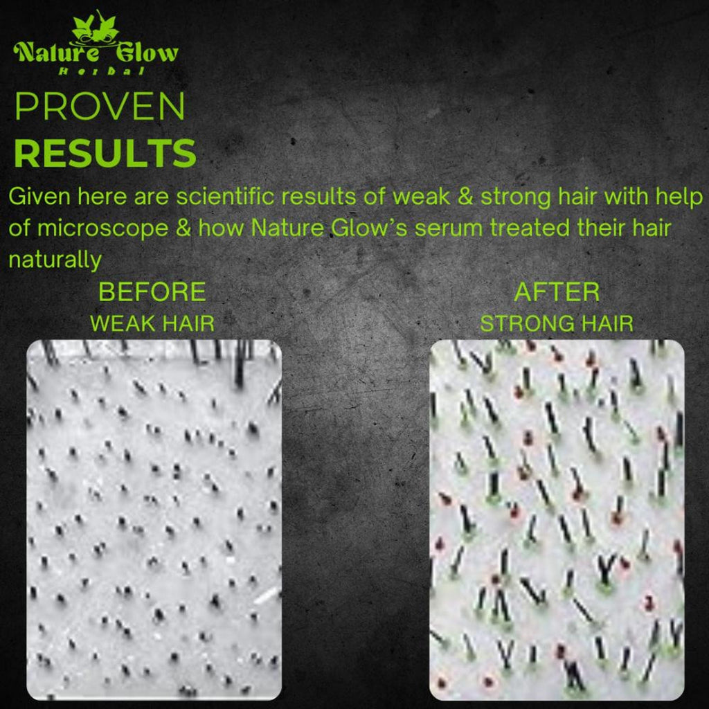 Nature Glow Herbal High Gloss Strengthen Hair Serum | Grocsy