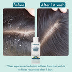 WishCare Hydrating AHA BHA Anti Dandruff Shampo-Reduces Flakes & Itchiness-100% Dandruff Reduction | Grocsy