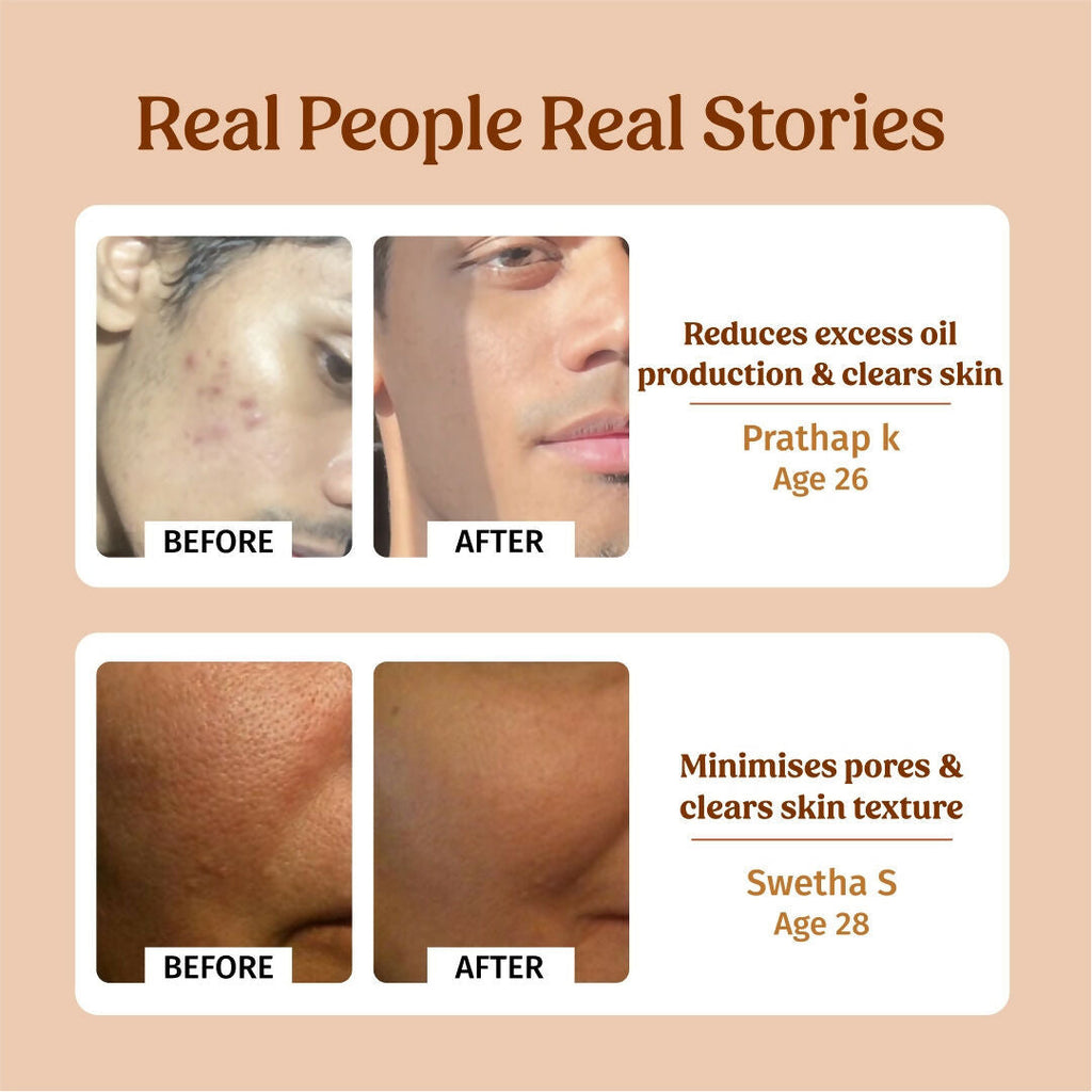 Vilvah Store Milk Face Toner (Earth marine water - Pore minimise) | Grocsy