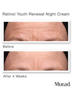 Murad Retinol Youth Renewal Night Cream | Grocsy