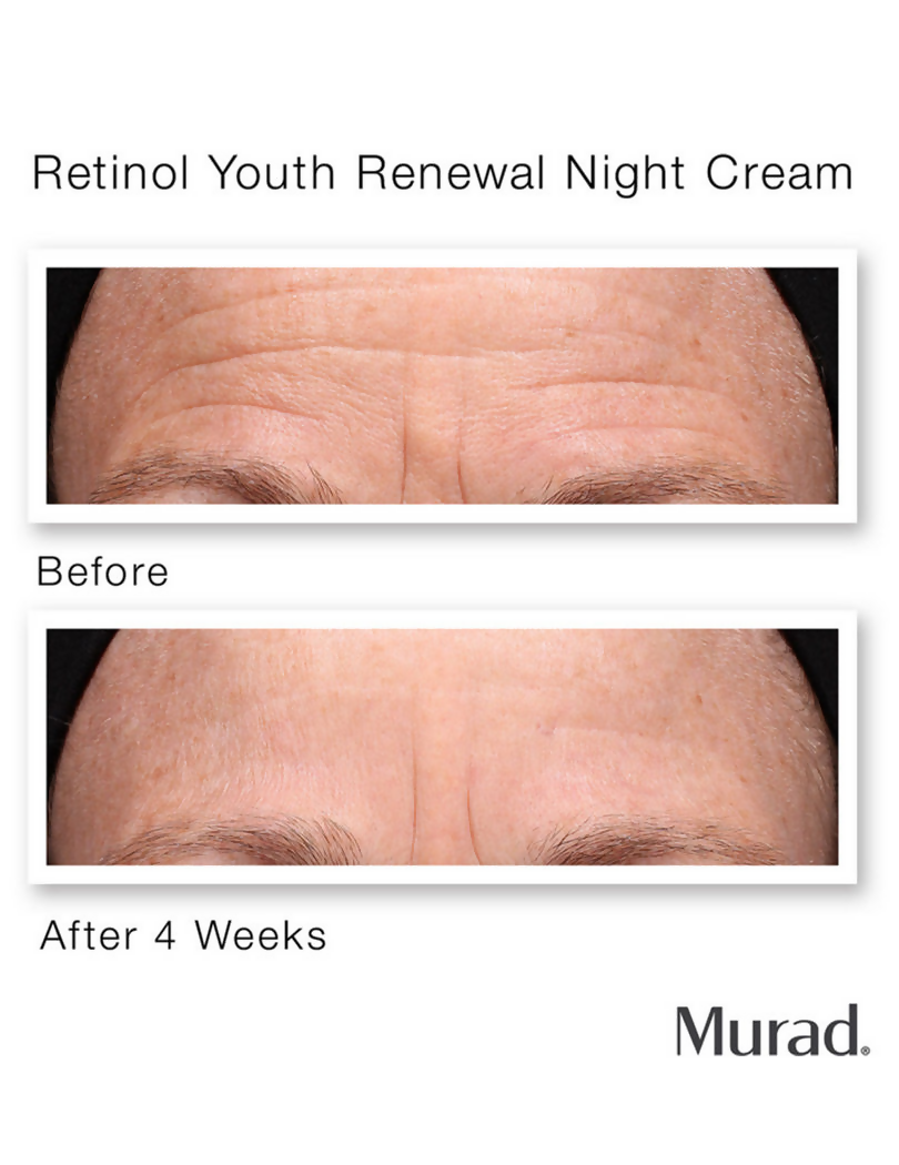 Murad Retinol Youth Renewal Night Cream | Grocsy