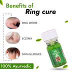 Cipzer RingCure - Swadesiicart