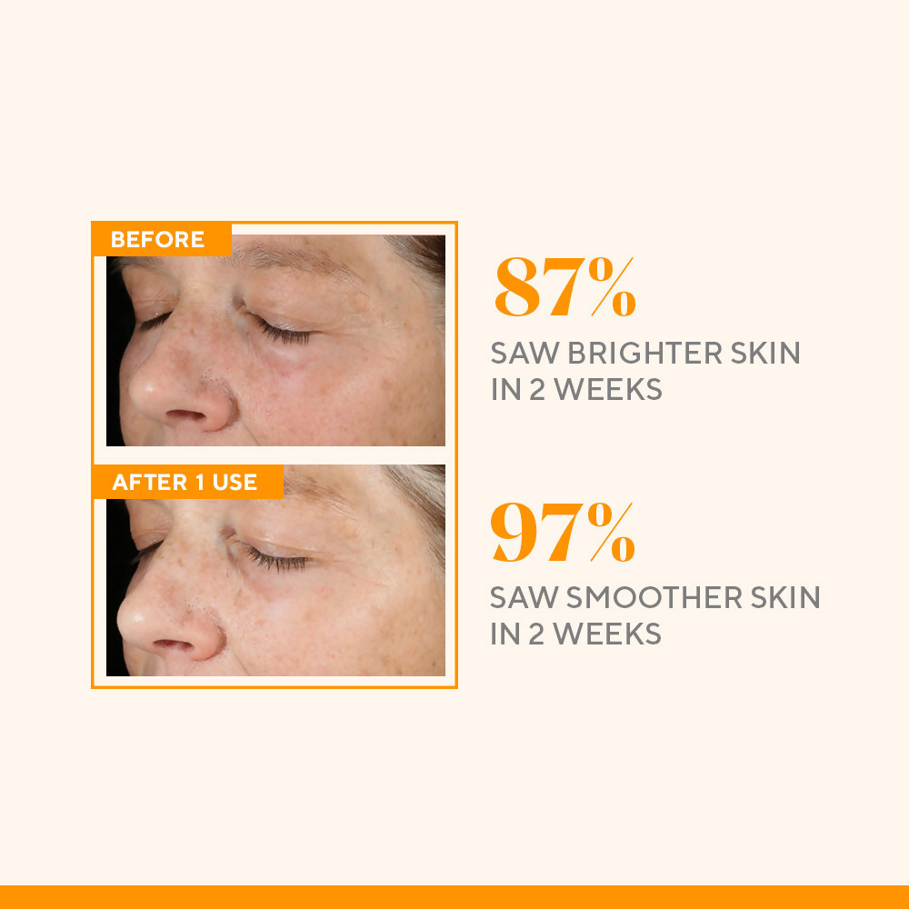Murad Environmental Shield Vitamin C Triple Exfoliating Facial | Grocsy