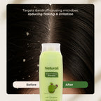 Naturali Dandruff Defence Shampoo with Tea Tree Oil & Cactus Extracts | Grocsy