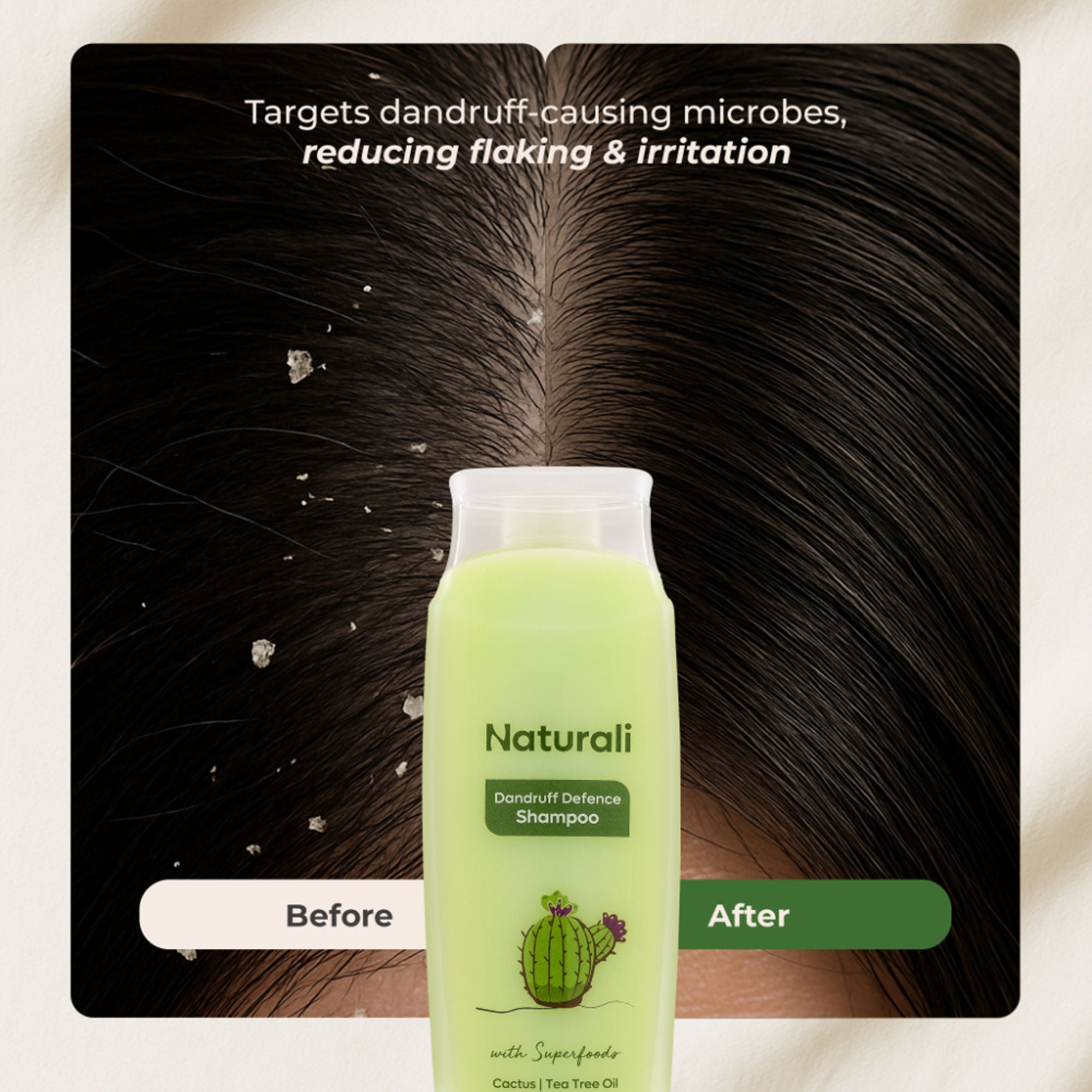 Naturali Dandruff Defence Shampoo with Tea Tree Oil & Cactus Extracts | Grocsy