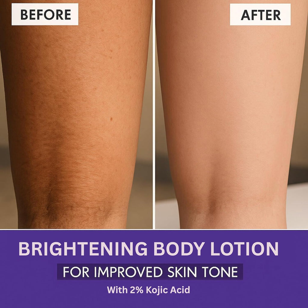 Bake 2% Kojic Acid Body Lotion SPF 30 | Grocsy