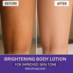 Bake 2% Kojic Acid Body Lotion SPF 30 | Grocsy