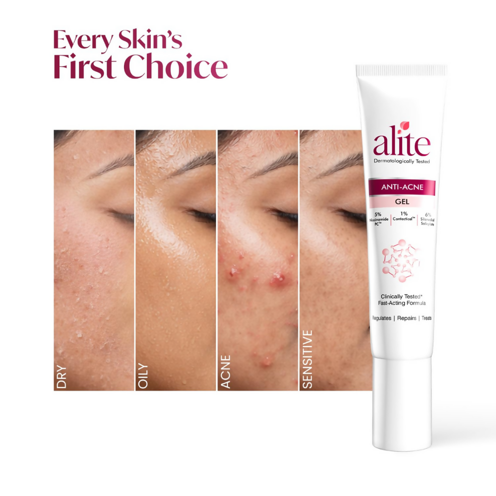 Alite Anti Acne Gel | Grocsy