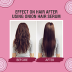 Nuerma Science Onion Hair Serum with Jaborandi Oil | Grocsy