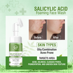 Nuerma Science Salicylic Acid Foaming Face Wash | Controls Acne & Pimples with Tea Tree, Neem & Tulsi Extract | Grocsy