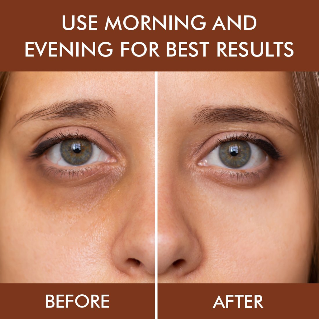 Nuerma Science Under Eye Gel Massage Roll-On to Reduce Dark Circles, Soothes Puffy Eyes | Grocsy