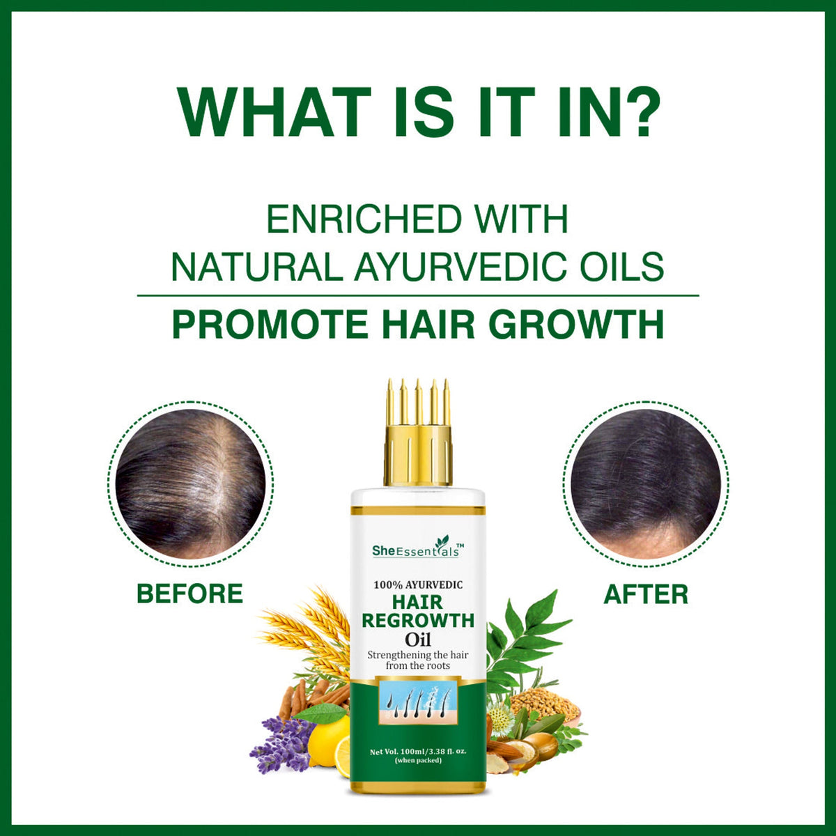 She Essentials Hair Regrowth Oil Infused With Rosemary For Anti Hair Fall & Hair Growth | Grocsy