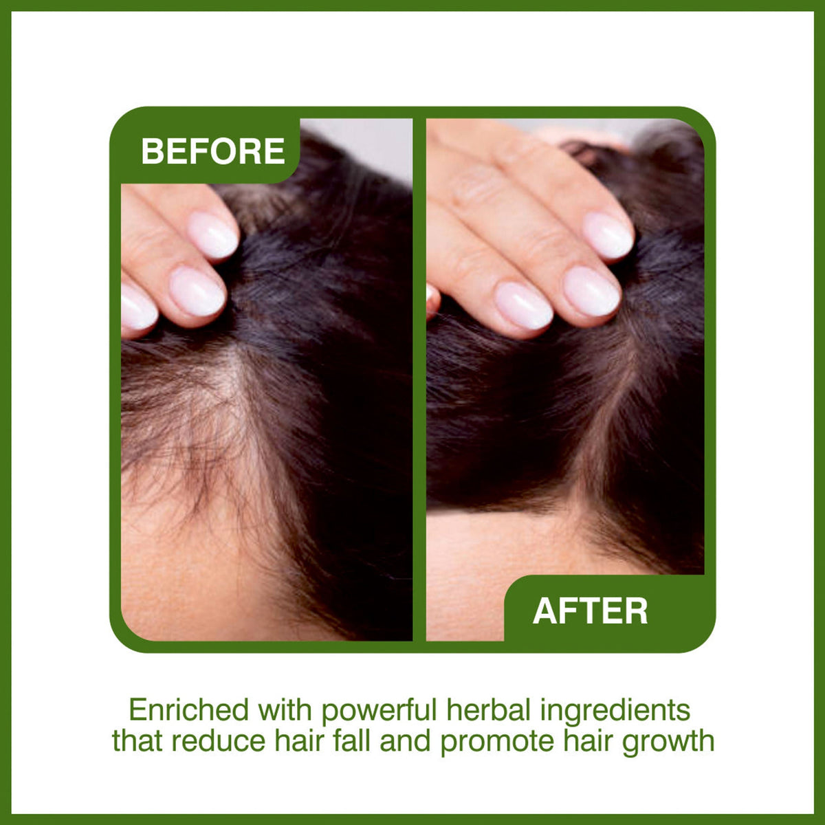 She Essentials Amla Bhringraj Hair Oil For Anti Dandruff & Hair Growth | Grocsy