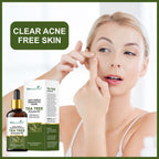She Essentials Rose Oil & Tea Tree Essential Oil Combo - Hair & Skin | Grocsy