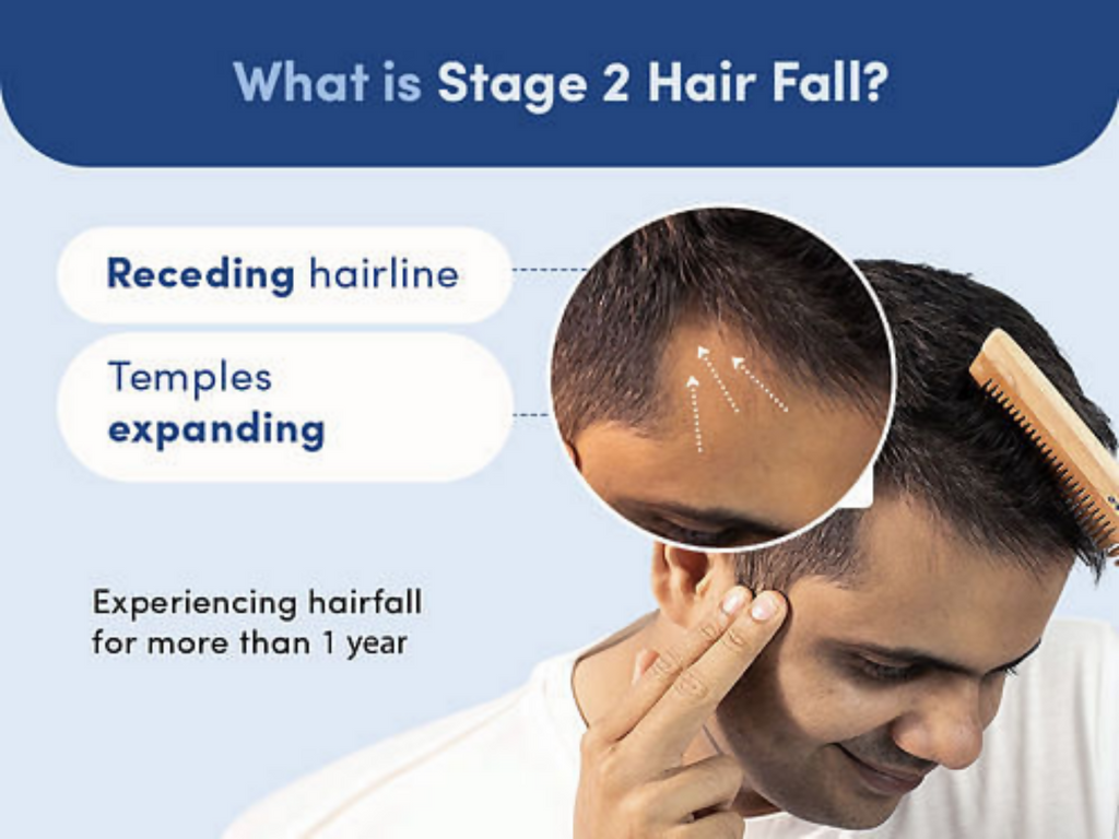 Man Matters Minoxidil 5% Roll On With Procapil | Grocsy