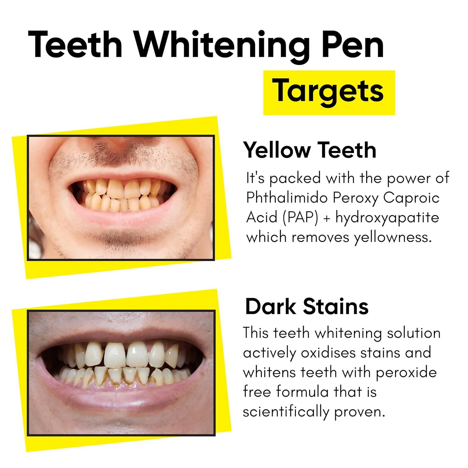 Masofta Teeth Whitening Pen With PAP+ For Yellow and Dark Stains | Grocsy